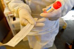 وزيرة الصحة: 6 إصابات جديدة بفيروس كورونا بالقدس و5 حالات شفاء