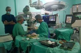 عملية جراحية معقدة تنقذ عين مريض في مستشفيات الخدمة العامة