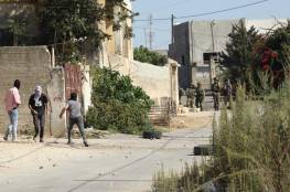 4 إصابات بالرصاص المعدني إحداها في الرأس خلال قمع الاحتلال مسيرة كفر قدوم الأسبوعية
