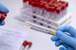 مستشفى "هداسا عين كارم" الإسرائيلي يشارك في إنتاج اللقاح الروسي ضد كوفيد-19