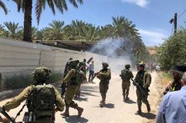 إصابة شاب بالرصاص خلال قمع الاحتلال مسيرة رافضة لخطة الضم الإسرائيلية شرق طوباس