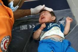 شهيدة وعدة اصابات في استهداف طائرات الاحتلال منازل بخانيونس وغزة (شاهد)