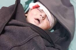 وزير الصحة يصدر تعليماته بنقل والدة الطفل"إشكيان" المصابة لمستشفى الشفاء بغزة