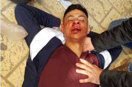 إصابة مقدسي إثر اعتداء مستوطنين عليه قرب المسجد الأقصى