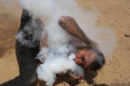 صحة غزة تكشف عن هوية "مصاب قنبلة الغاز في وجهه" وحالته الصحية