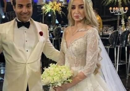 صورة هنا الزاهد تنقل إلى المستشفى خلال شهر العسل وأحمد فهمي يوضح سما الإخبارية