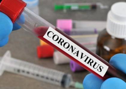 الصحة الفلسطينية: تسجيل 3 حالات وفيات و290 إصابة جديدة بفيروس كورونا