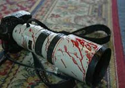 دعم الصحفيين : 139 صحفياً أصيبوا منذ انتفاضة القدس بينهم (16 )صحافية