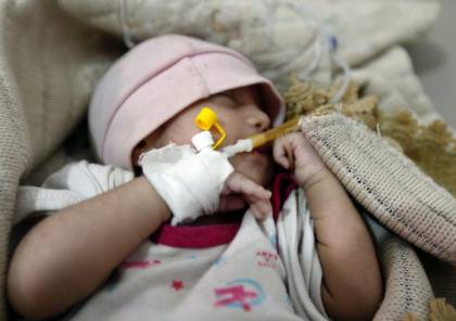 ارتفاع وفيات الكوليرا باليمن إلى 942 وعدد المصابين تجاوز 124 ألفاً