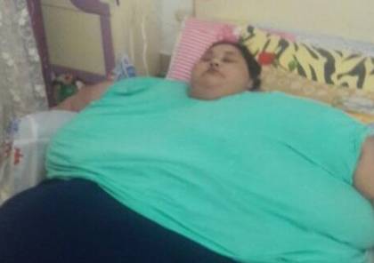 الهند تتدخل عبر "تويتر" لعلاج مصرية وزنها نصف طن