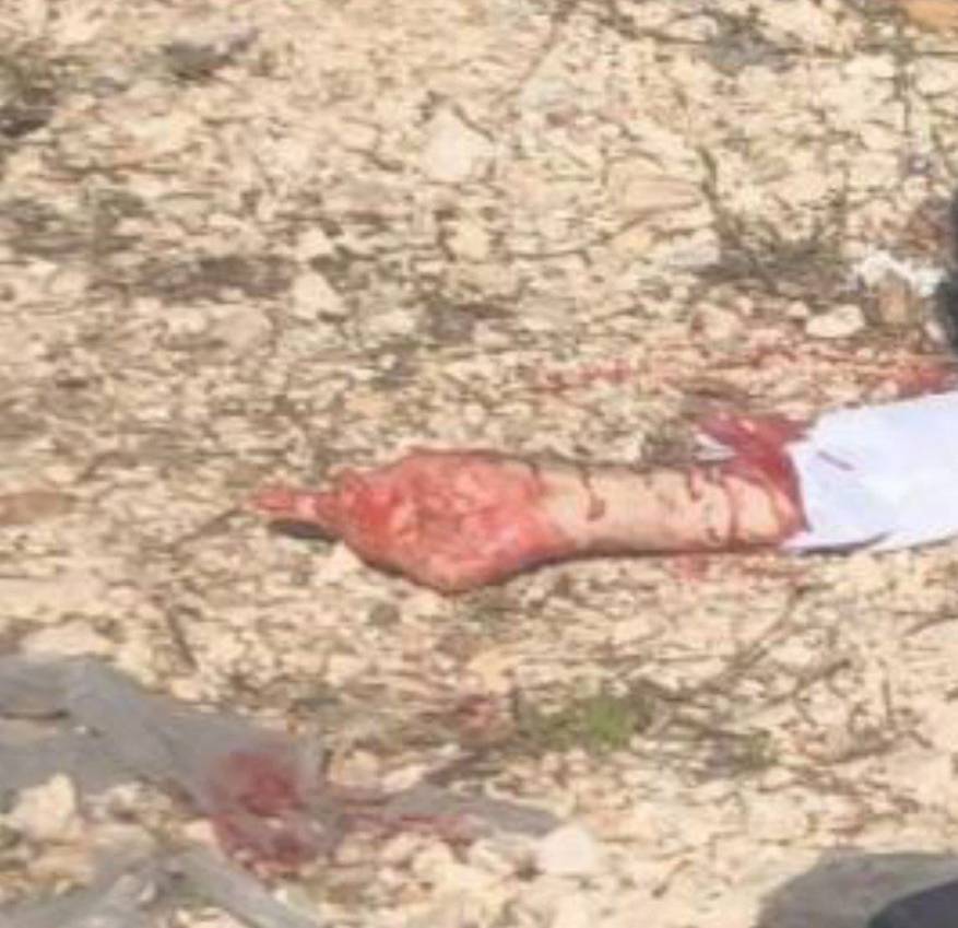 مقتل مستوطن وإصابة 3 اخرين في عملية دهس وطعن شمال الخليل واستشهاد المنفذين ..