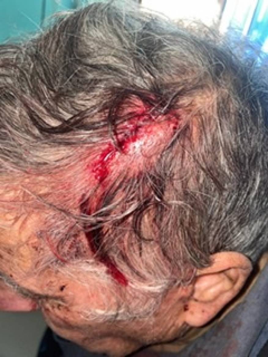 67C35473-3F35-49A6-9F73-12670B40CD62