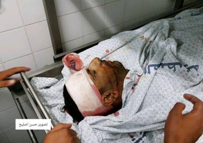 صور: شهيدان احدهما طفل ومئات الاصابات برصاص قوات الاحتلال في جمعة "الشهداء الاطفال"