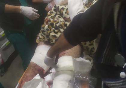 إصابة خطيرة لمواطن بانفجار جسم مشبوه في الخليل