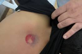 إصابة خطيرة برصاص الاحتلال في مخيم عايدة
