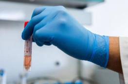 إسرائيل تعلن تقدماً كبيراً في التوصل للقاح مضاد لفيروس كورونا