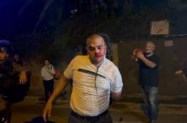 صور : إصابة 20 مواطناً ومتضامناً واعتقال فتاة وشابين خلال مواجهات بالشيخ جراح