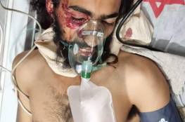 إصابة مستوطن بجروح خطيرة.. الاحتلال يعتقل شابًا بعد إصابته وآخرين في الخليل