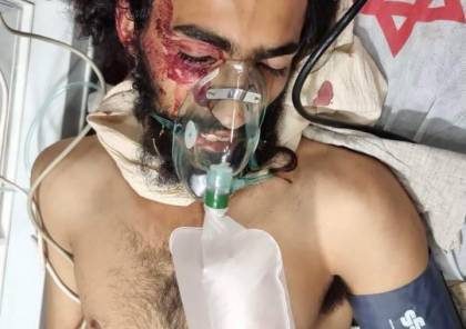 إصابة مستوطن بجروح خطيرة.. الاحتلال يعتقل شابًا بعد إصابته وآخرين في الخليل