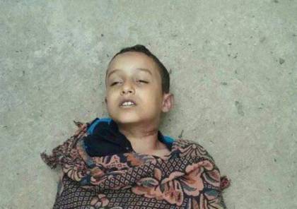 اليمن: طفل ينتحر شنقاً لأن لا ملابس جديدة لديه للعيد!