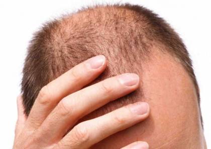 الحل الأمثل لعلاج تساقط الشعر
