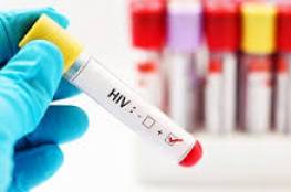 الصحة العالمية والأمم المتحدة  تطالب حكومات العالم بمحاربة الايدز مثلما تحارب فيروس كورونا