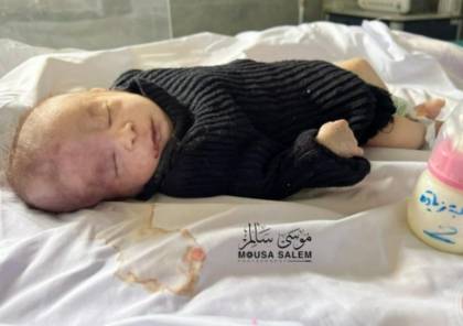 ارتفاع عدد الأطفال ضحايا الجوع بمستشفى كمال عدوان إلى 15