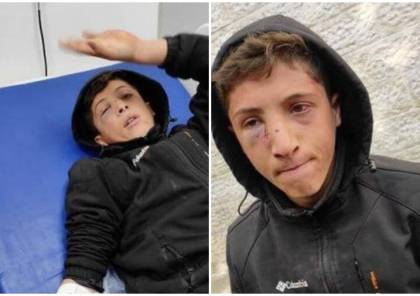 جنود الاحتلال يعتدون على فتى من النبي صالح