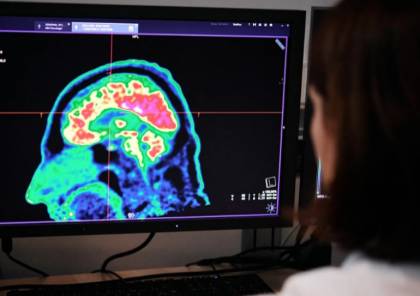 لأول مرة.. علماء يرصدون نشاط دماغ الإنسان عند الوفاة