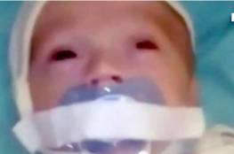 شاهد.. لصق "مصّاصة" على فم طفل بمستشفى روسي