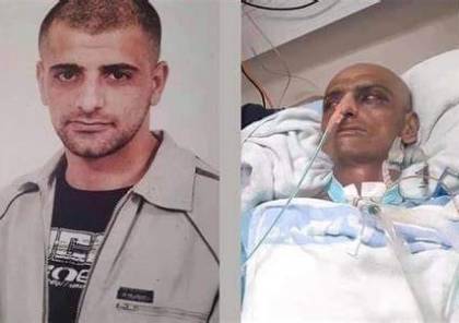 الأسير السابق حسين مسالمة بوضع صحي حرج جدًا في مستشفى "هداسا"