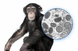 "الصحة العالمية": تسجيل 131 حالة لجدري القردة في 17 دولة