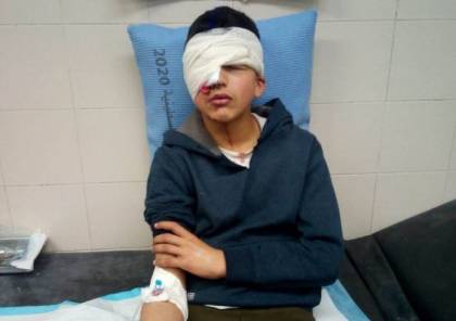 اصابة طفل برصاص مطاطي في عينه بالخليل