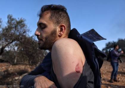 إصابة صحفي بـ"المطاط" وعشرات المواطنين بالاختناق خلال مواجهات مع الاحتلال في بيتا