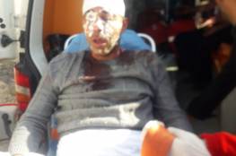 إصابة 3 مواطنين وتحيطم 4 مركبات إثر هجوم للمستوطنين قرب برقة شمال نابلس