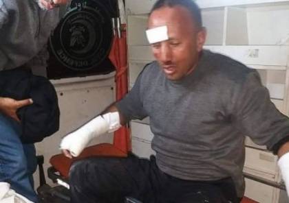 إصابة رجل إطفاء والدفاع المدني ينفذ 75 مهمة في قطاع غزة