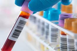 ثورة علمية : اختبار دم جديد يحدد فرص البقاء على قيد الحياة
