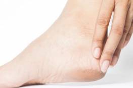 أسباب تشقق جلد القدمين لدى النساء في الصيف.. حلول وعلاجات