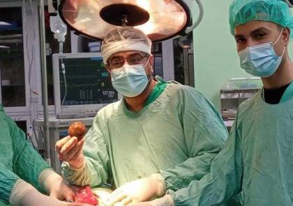 استئصال حصوة كبيرة الحجم من الكلى بمستشفى الخدمة العامة في غزّة