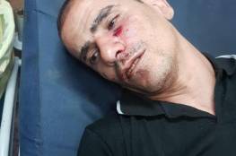 اعتقالات بالضفة واصابة 20 مواطنا في مواجهات نابلس فجرا 