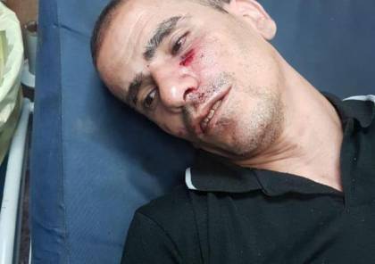 اعتقالات بالضفة واصابة 20 مواطنا في مواجهات نابلس فجرا 