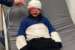 إصابة طفل في اعتداء للمستوطنين بالخليل