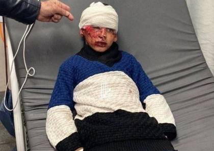 إصابة طفل في اعتداء للمستوطنين بالخليل