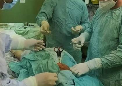شاهد: أطباء بغزة ينقذون طفل اخترق مقص رأسه