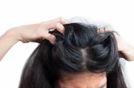 11 مكونا شائعا ولكنه ضار في الشامبو يجب تجنبه لمكافحة تساقط الشعر