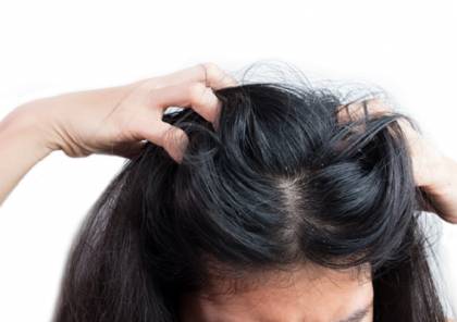 11 مكونا شائعا ولكنه ضار في الشامبو يجب تجنبه لمكافحة تساقط الشعر