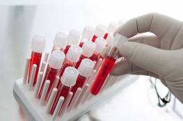 دراسة تكشف فصيلة الدم الأكثر مقاومة لكورونا