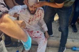 "أوقاف القدس" تدين اعتداء شرطة الاحتلال على المصلين في الأقصى