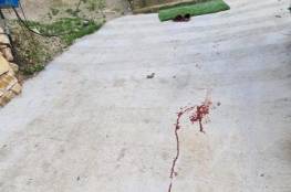 إصابة طفلة في هجوم للمستوطنين جنوب نابلس.. صور