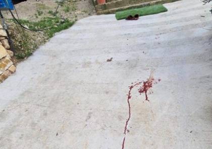 إصابة طفلة في هجوم للمستوطنين جنوب نابلس.. صور